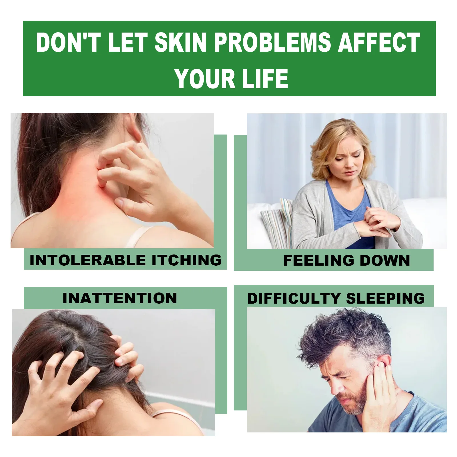 South Moon Eczema Treatment Cream Anti Itching Remove Psoriasis Dermatitis Eczematoid Repair Skin Care Antibacterial Ointment