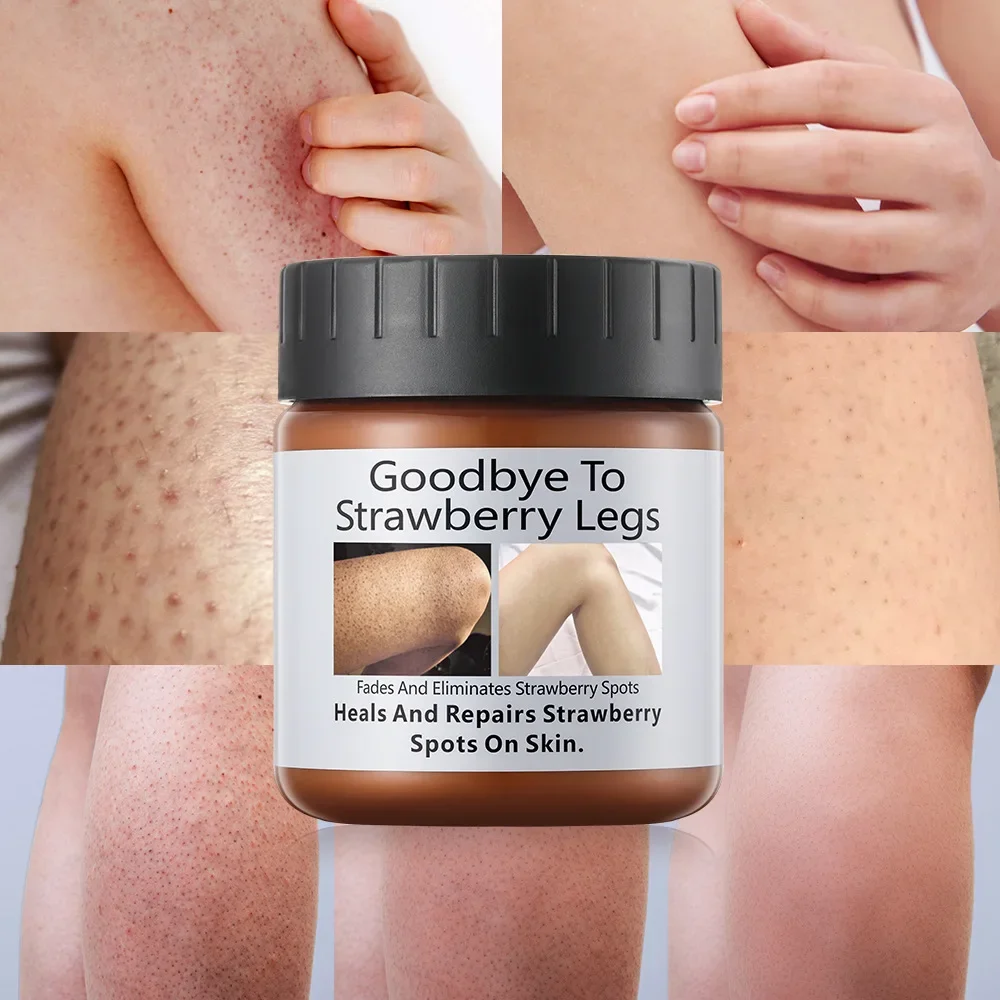 Chicken Skin Removing&Cuticle Removing Smooth&Tender Skin Moisturizing lotion Body Cream Chicken Skin Removing Leg Beauty Cream body tender