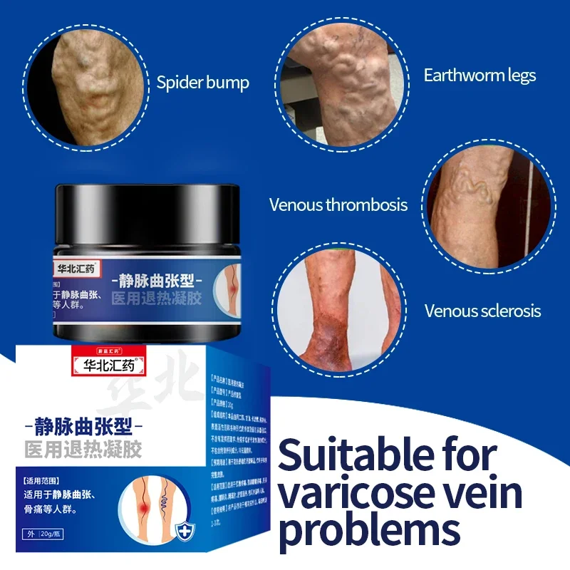 20g Varicose Veins Remover Cream Phlebitis Pain Relief Health Care Varicosity Angiitis Spider Treatments Herbal Medical Plaster