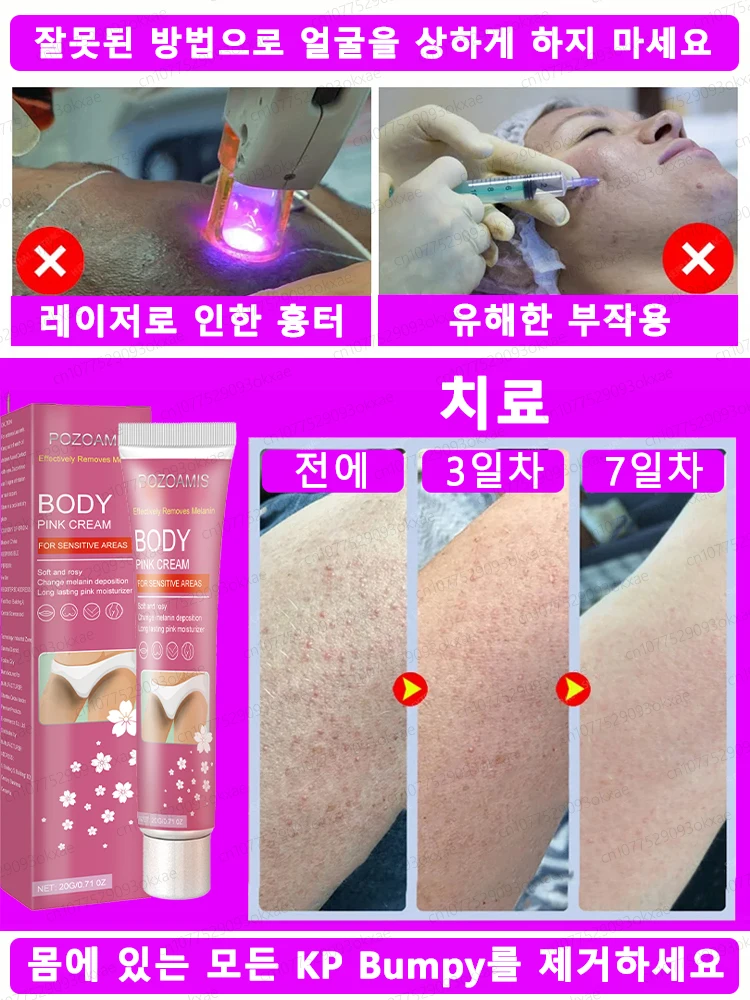 미백 크림 사적인 부위 겨드랑이 표백 세럼 안쪽 허벅지 미백 엉덩이 무릎 미백 허벅지 안쪽 사적인 부위 어두운 멜라닌 제거