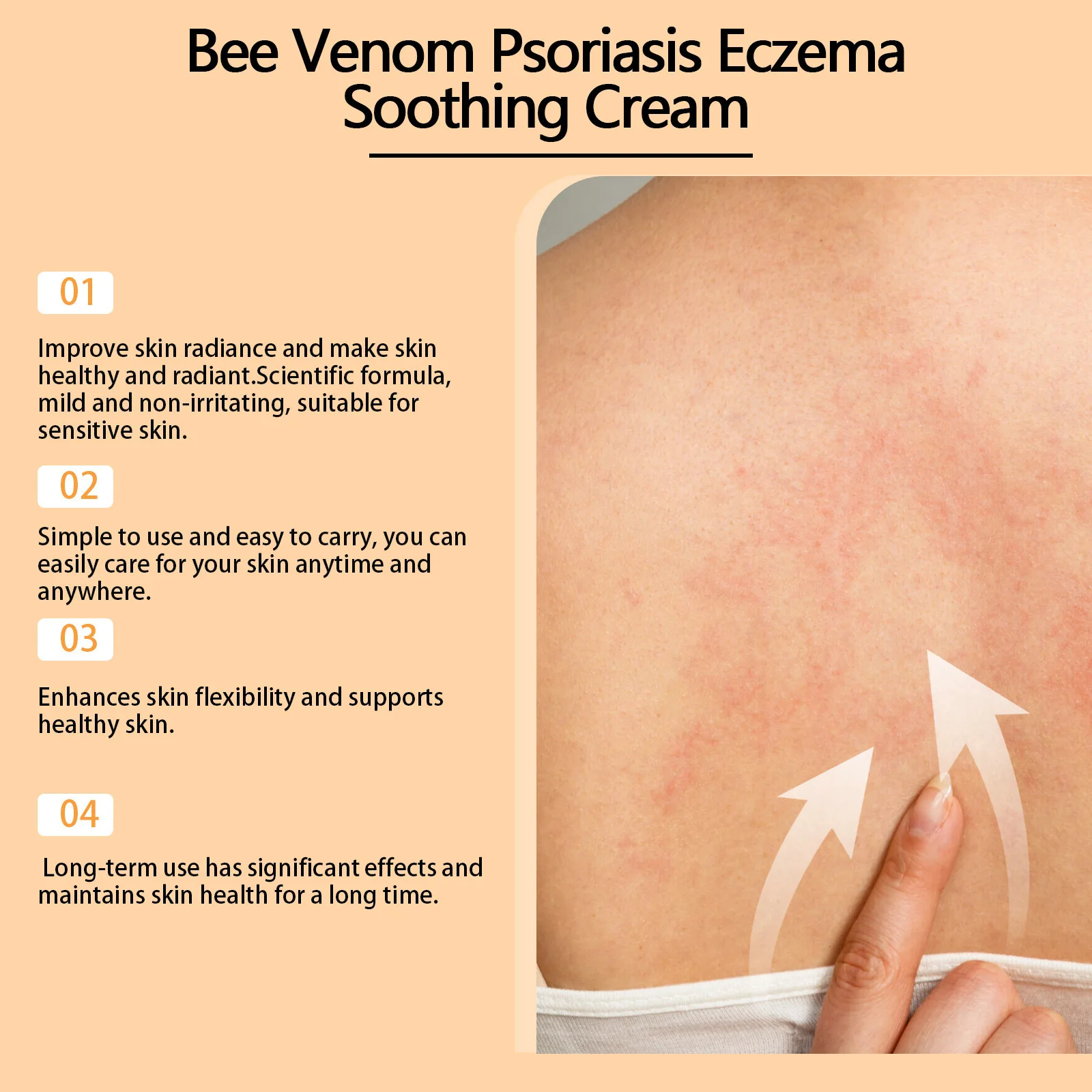 Bee Vonom Psoriasis Treatment Cream Eczema Urticaria Skin Itching Swelling Antibacterial Relieve Rash Desquamation Ointment Care