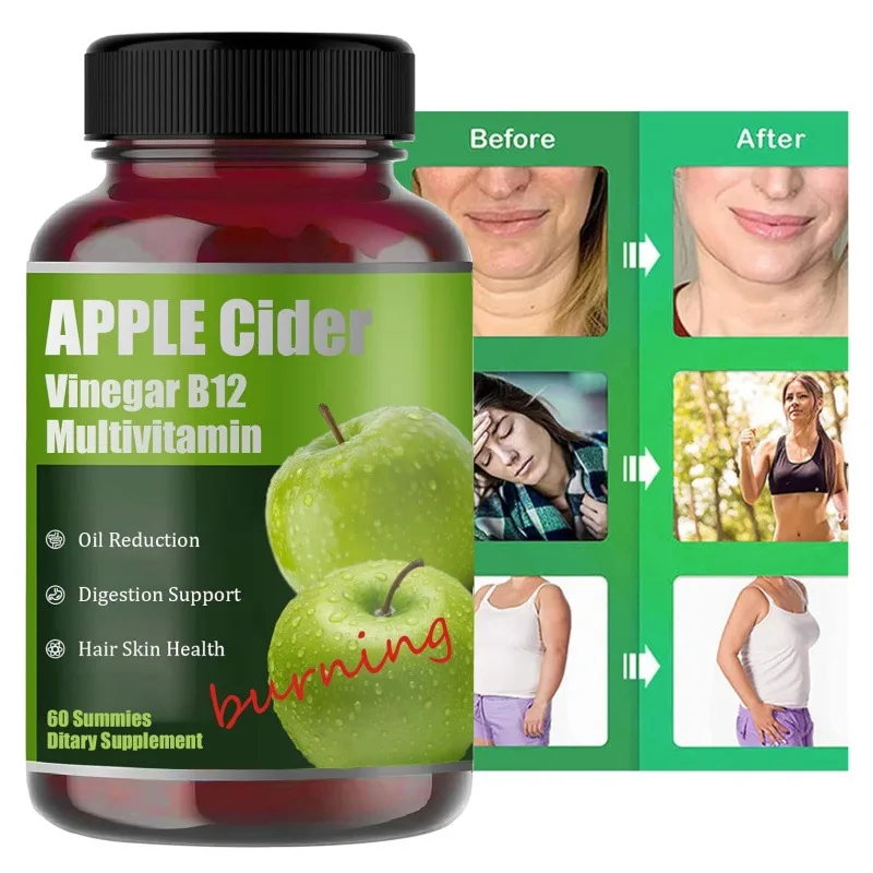1 bottle of apple cider vinegar B12 complex vitamin for beauty anti-aging anti fatigue plasticity and digestion promotion