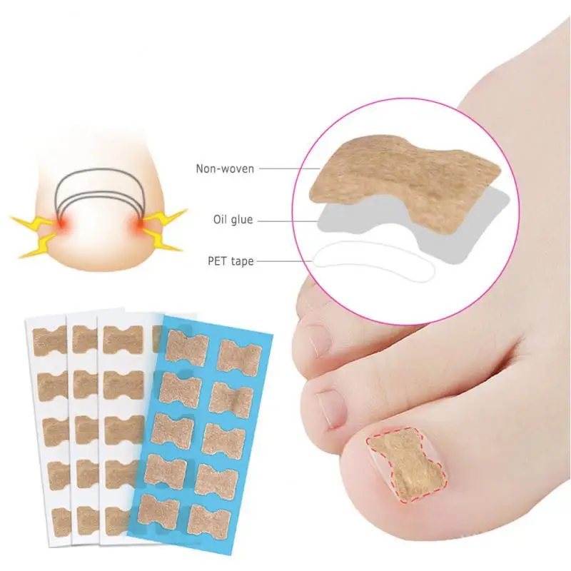 

Nail Correction Stickers Ingrown Toenail Corrector Patches Paronychia Recover Corrector Pedicure Tools