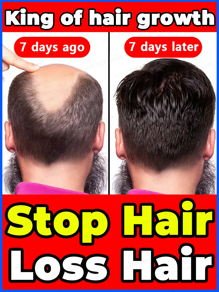 

Быстрая зарядка, восстановление облысения за 7 дней, попрощайтесь с облысением