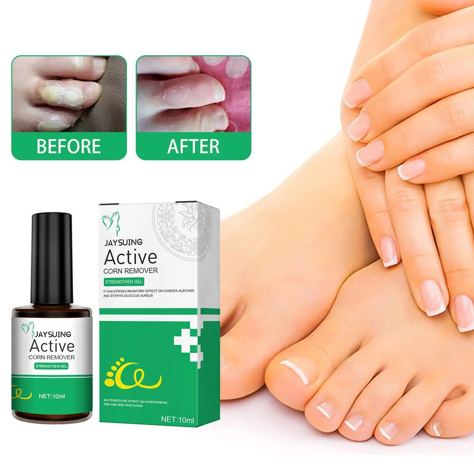 

Powerful Foot Corn Remover Useful Foot Callus Remover Strengthen Remover Tag Extra Gel Remove Remover Warts Skin Corns O8H4