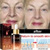 Wrinkle Remove Serum Anti-Aging Essence Fade Fine Line Lifting Firming Whitening Skin Care 4