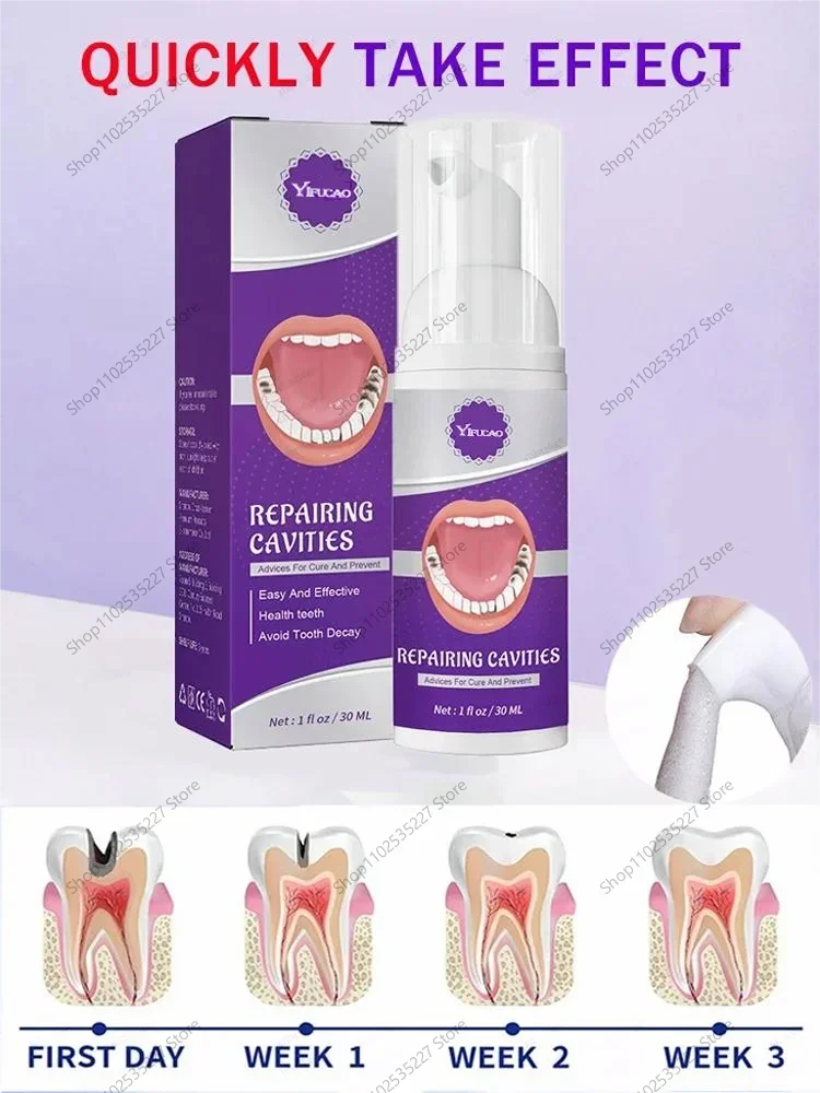 Tooth decay Repair Repairing
