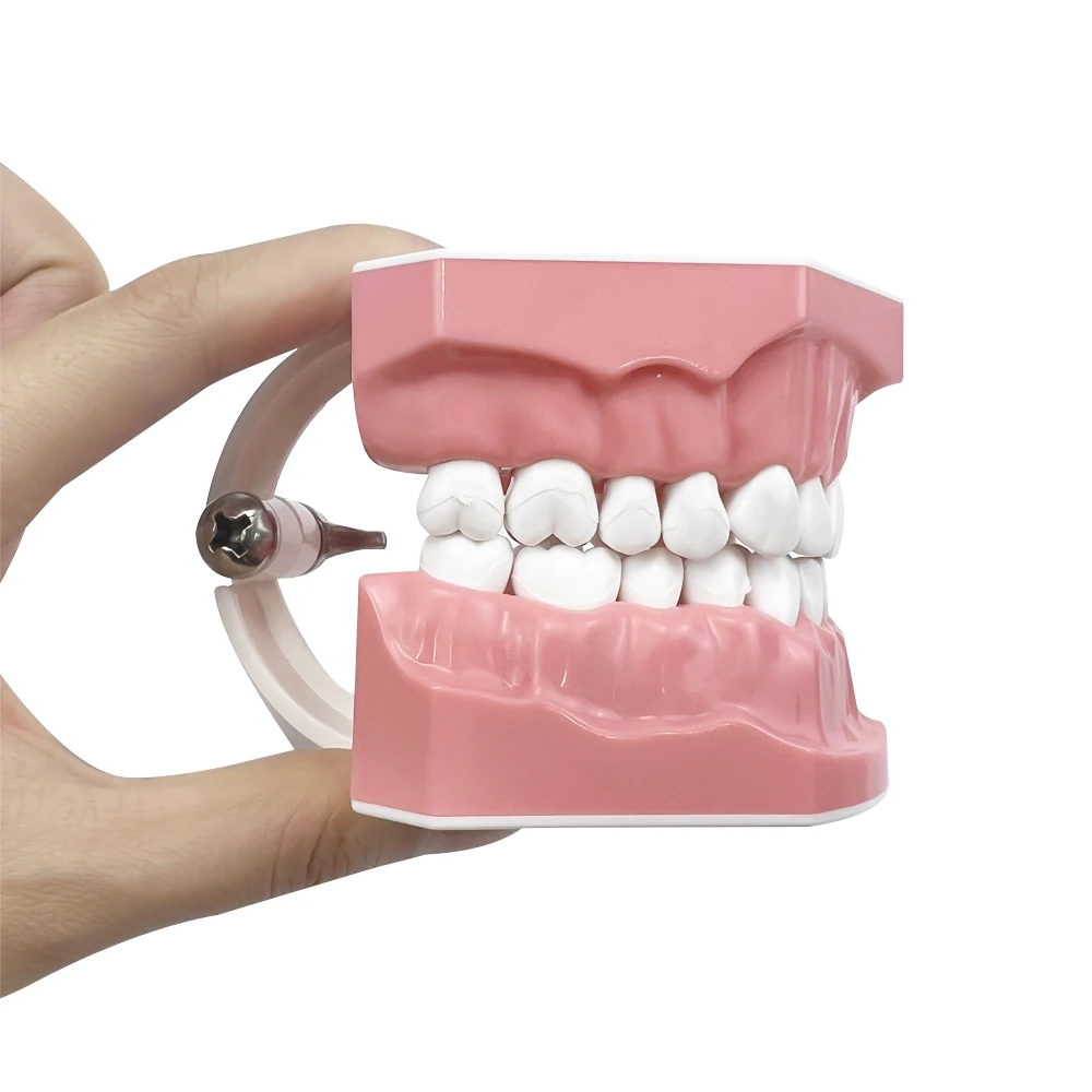 Dental Implant Education Model