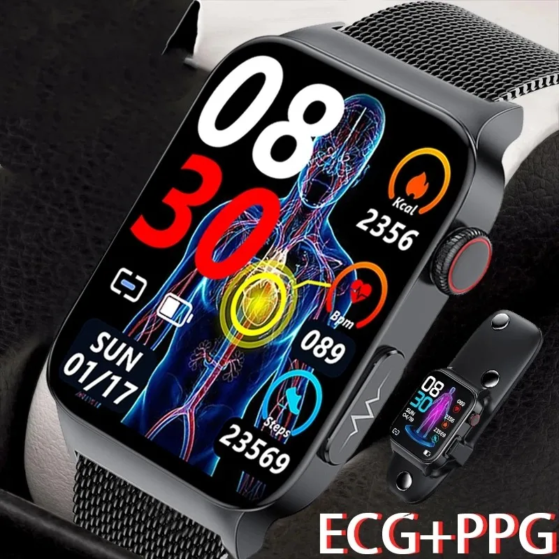 

2023 New watch for Xiaomi Body Temperature Blood Glucose Electrocardiogram Monitoring Health smartwatch for men and women