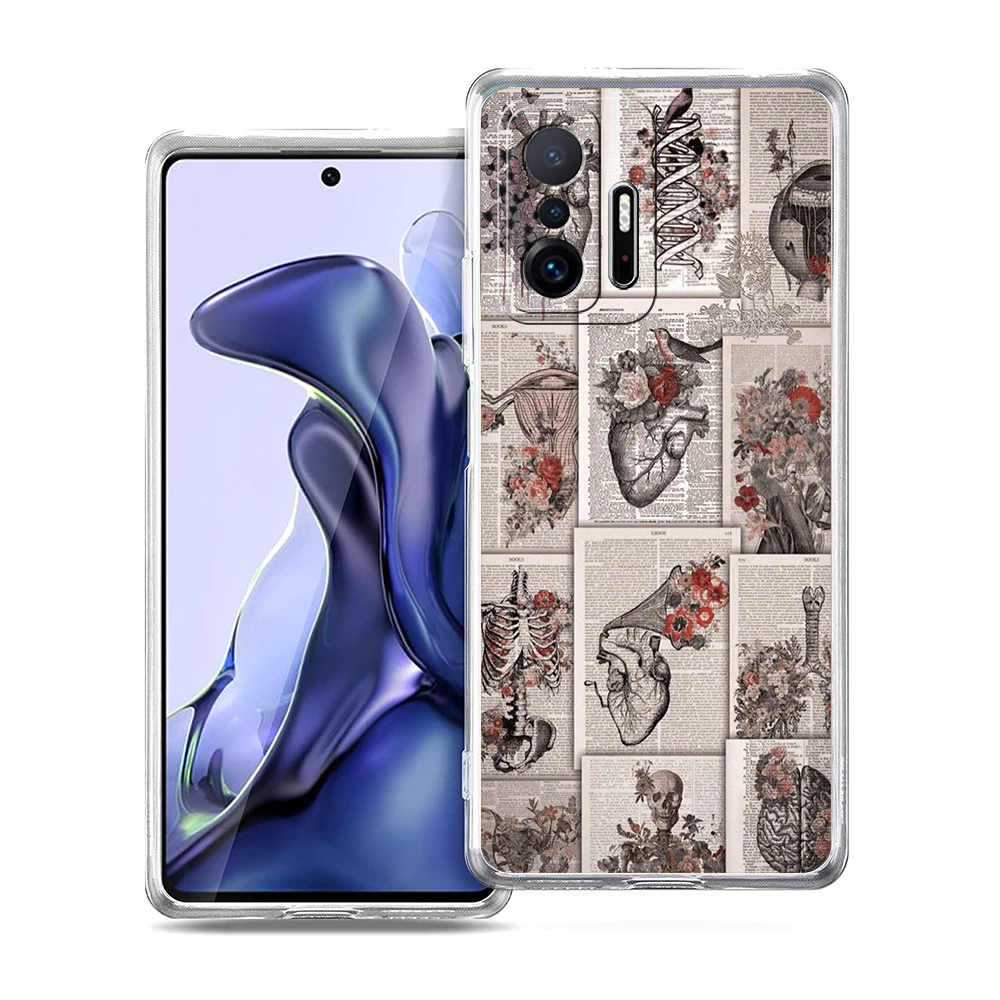 Transparent Soft TPU Shell with Anatomy Skeleton Chalkboard Heart Design