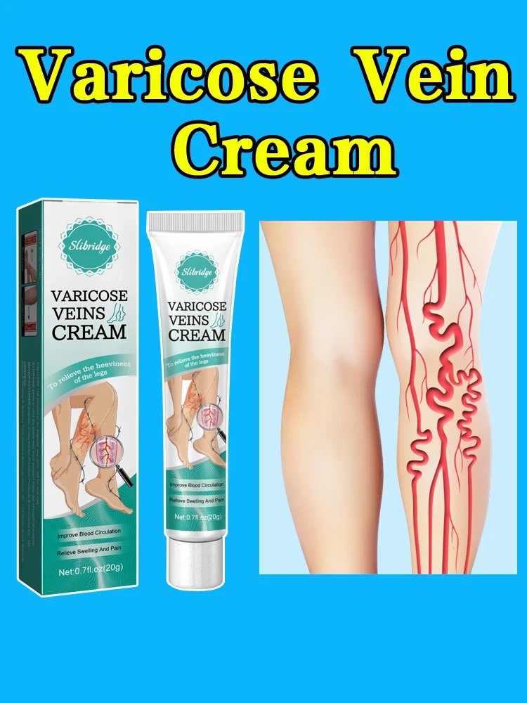 

Varicose Vein Cream