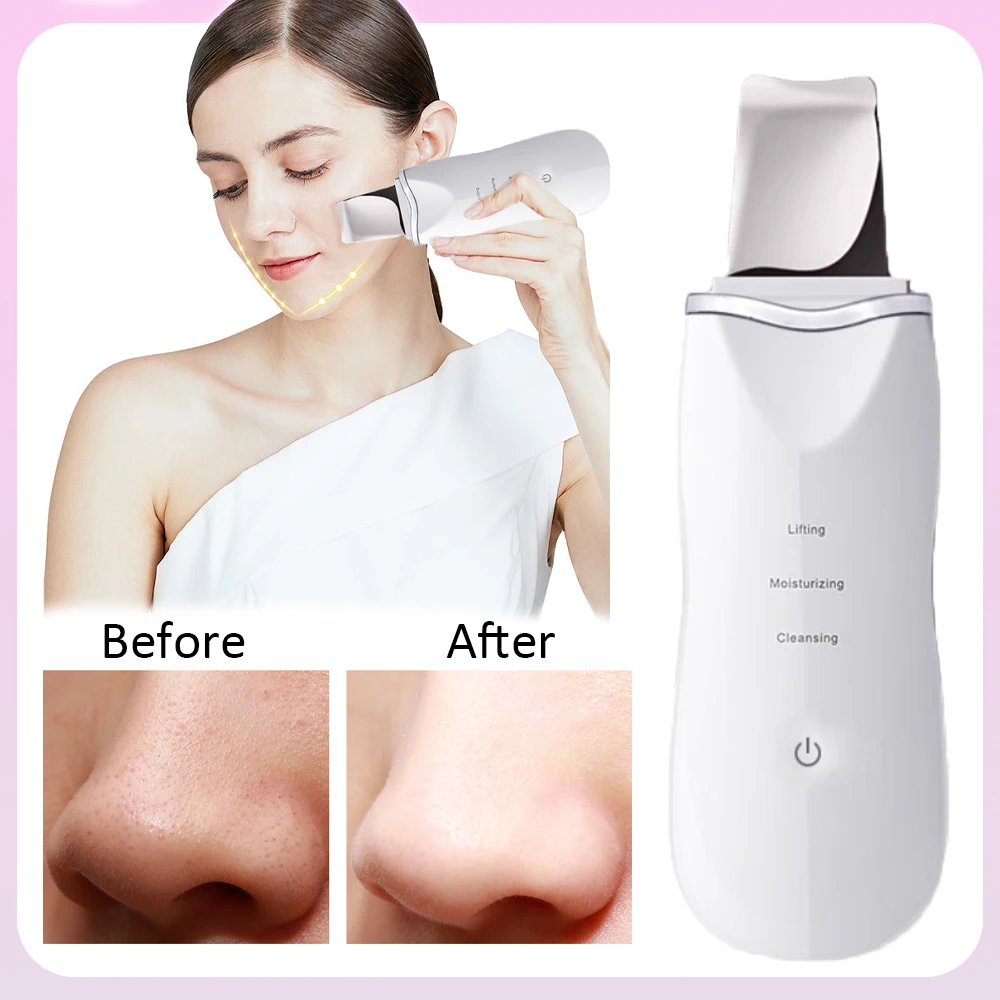 Deep Cleaning Electric Skin Scrubber Blackhead Remover Facial Shovel Cleanser