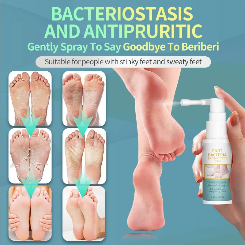 Рисунок 5 - Спрей от грибков для ног эффективно удаляет берибери