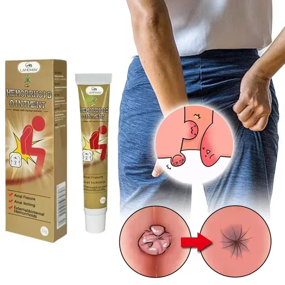 Hemorrhoid Removal Cream New Natural Herbal Extract Relieve Anal Anus Swelling Bleeding Gel