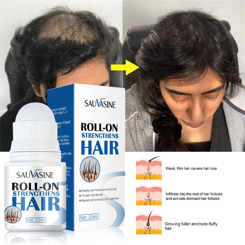 

Hair Scalp Care Serum Anti Hair Loss Rollerball Smoothing Nutrient Strengthening Black Moisturiz Serum Scalp Treatments Beauty