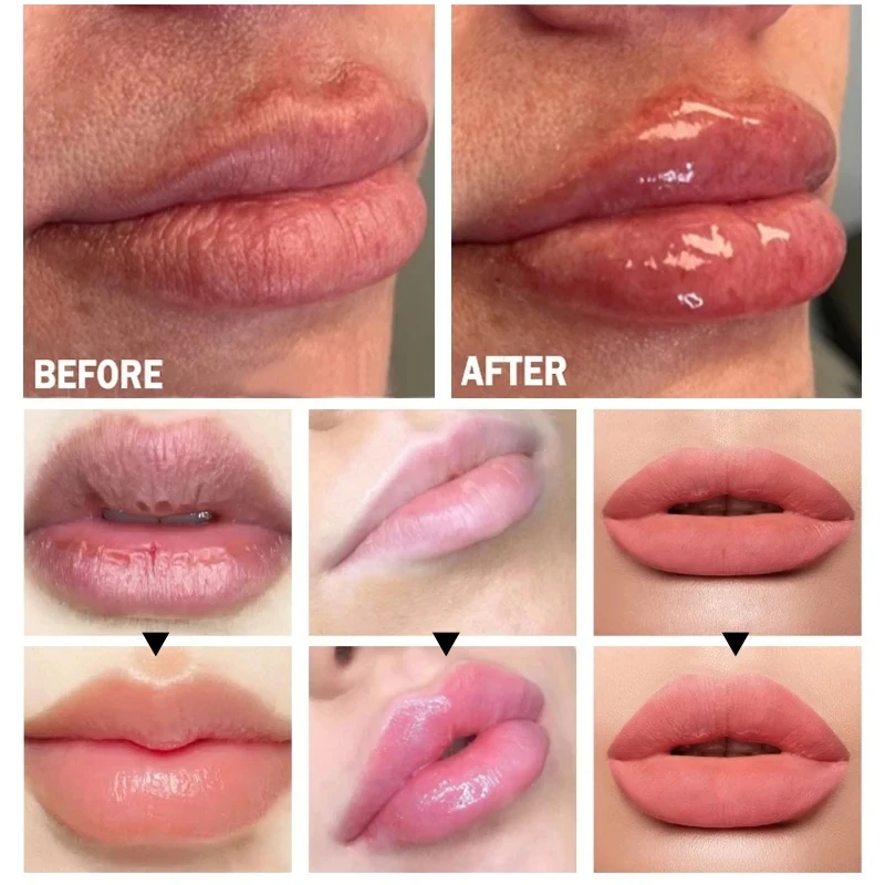 Lip Plump Serum Increase Lips Elasticity Instant Volumising Essential Oil Reduce Fine Lines Moisturizing Nourish Sexy Lip Care 5
