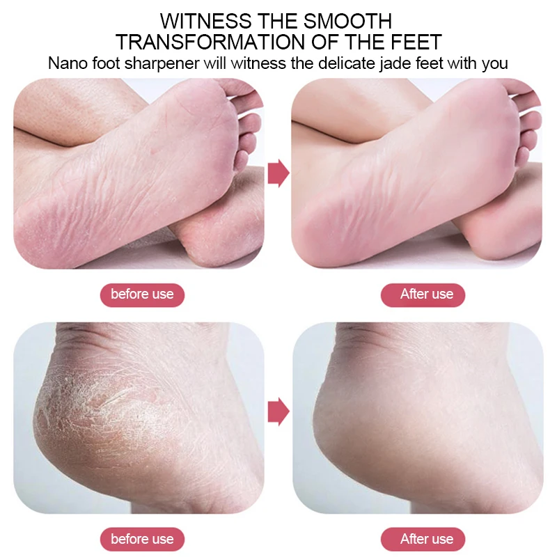 Foot File 1PC Nano Glass Foot Plate Exfoliate Foot Hard Dead Skin Pedicure Remover Scrubber