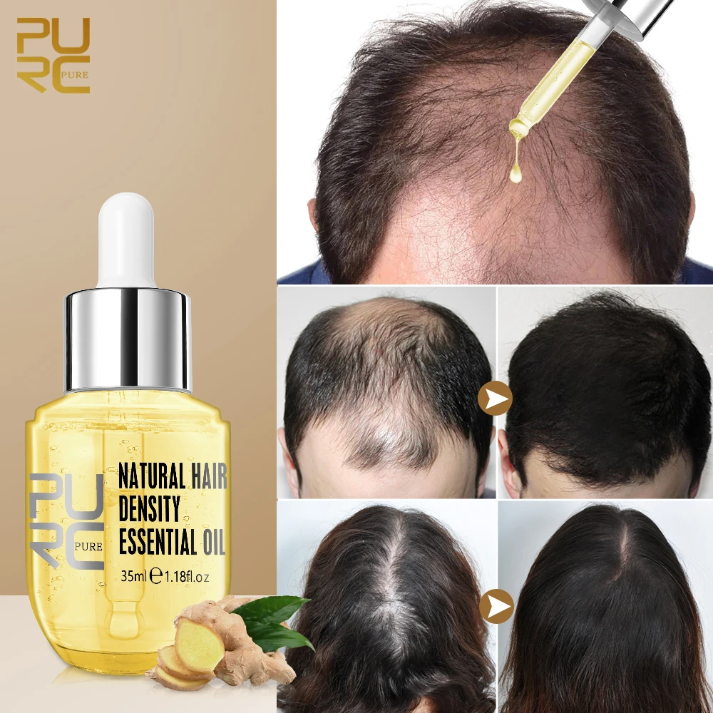 

PURC Ginger Hair Growth Products Prevent Hair Loss Essential Oil Fast Growing Scalp Treatment Beauty Health for Men Women