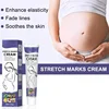 Swelling Marks Remove Skin Cracks Body Creams 1