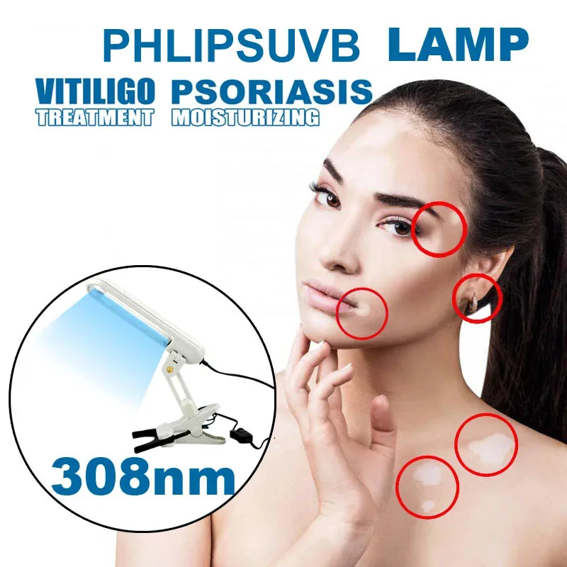 

Glenn 311NM UVB Phototherapy Lamp Device for Vitiligo Treatment UV NarrowBand Ultraviolet Light Therapy Psoriasis Spots