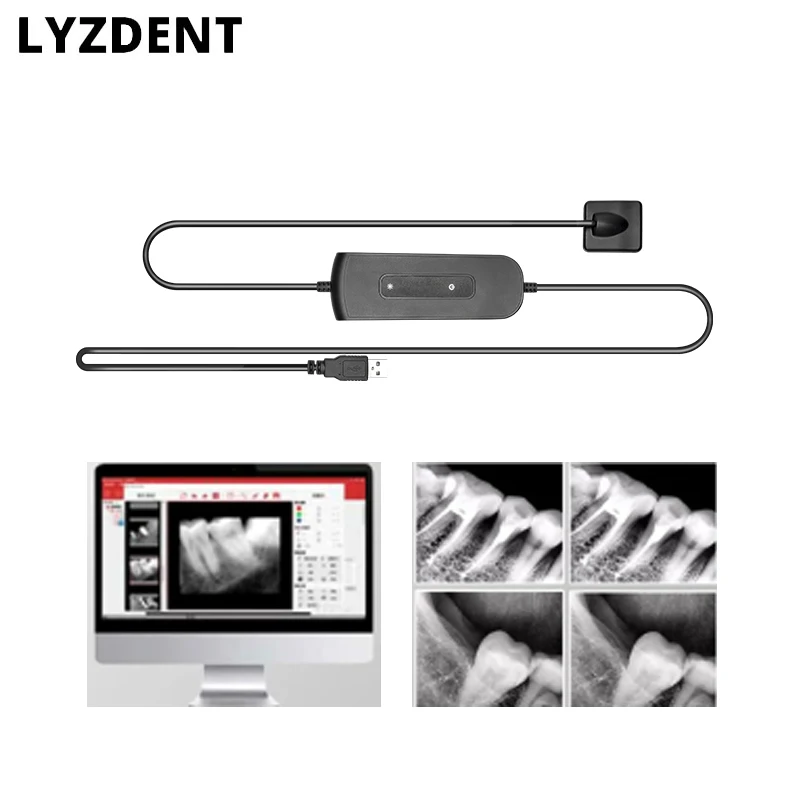 

Digital cameras Dental Sensor X-Ray Radiovisiograph Digital Sensor Intraoral Imaging System HD Image Dentistry Tool