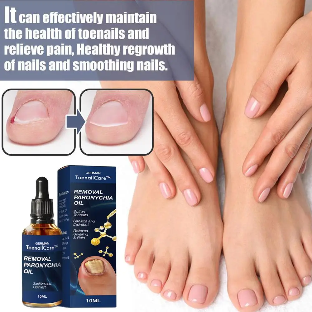 Endogenous Nail Repair Care Essential Oil Essence Clean and Remove Toenail Treatment Feet Care Removal Paronychia Oil