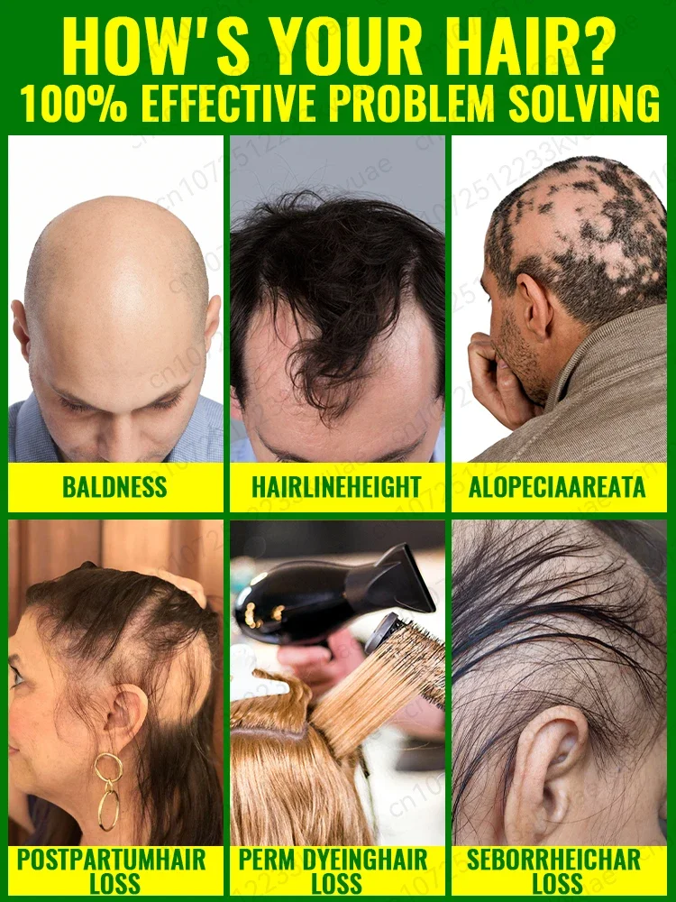 Rapid hair growth essential oil, repair baldness