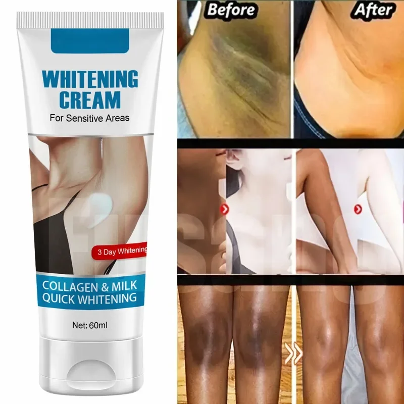 Body Whitening Cream Remove Dull Pigments Private Parts Bleach Knees Dark Spot Corrector Intimate Areas Brighten Cream Skin Care private area whitening cream removing pigment precipitation moisturizing brightening intimate area underarm joint skin care 30ml