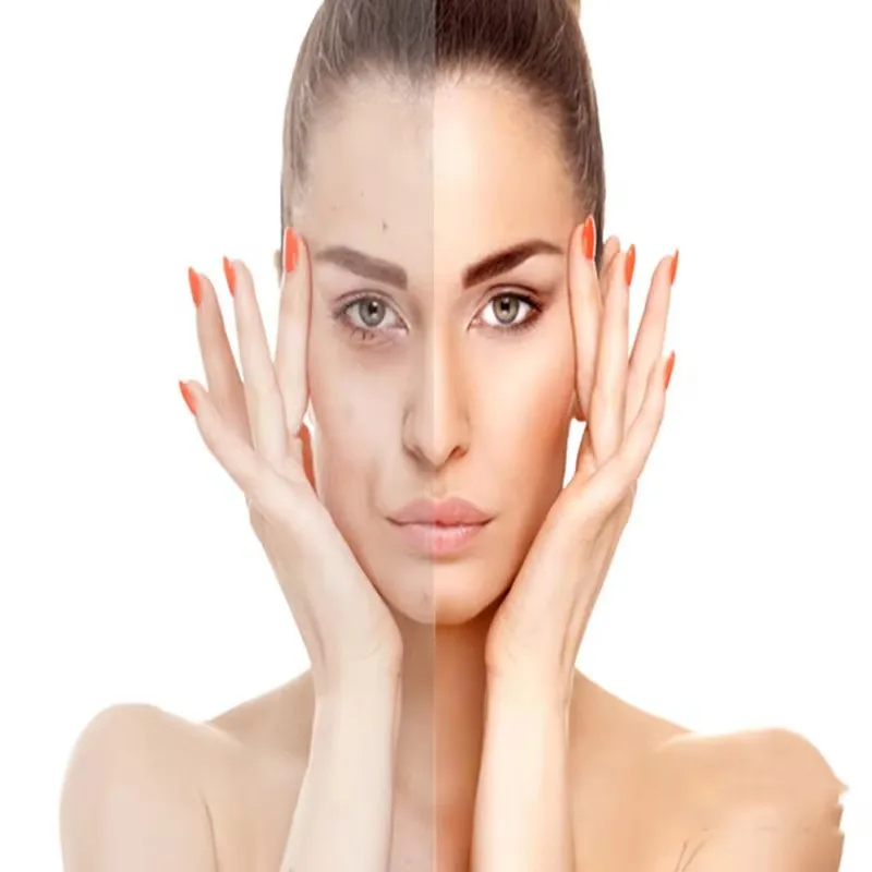 Hyaluronic Acid Powder Cosmetic Grade High Polymer 99%