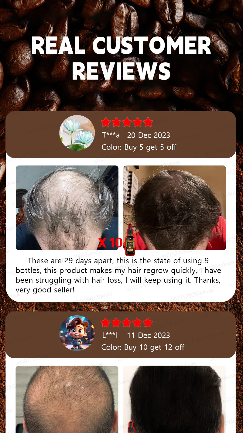 Description Picture 4 of itemUnisex Hair Growth Oil Hair Loss Treatment Rapid Hair Growth Effective Baldness Repair Hereditary Postpartum