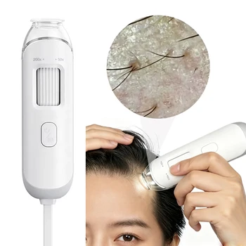 NUOVO Dermatoscopio 50X/200X per Analisi del Cuoio Capelluto e dei Follicoli Piliferi, Strumento Diagnostico per la Cura della Pelle