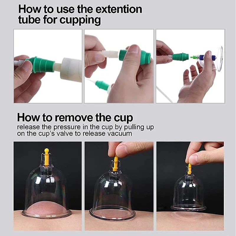 24 Cans JINGKANGVentosa Chinese Vacuum Cupping Therapy Set Pull Out Vacuum Therapy Massagers Curve Suction Ventosaterapia Xicara 4