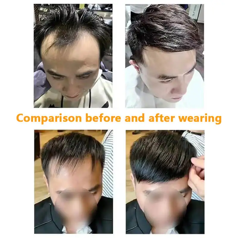 Male Hair Prosthesis Silicone Microskin Base 100% Human Hair Replacement Mens Toupee Breathable Biological Scalp Wigs For Men 6