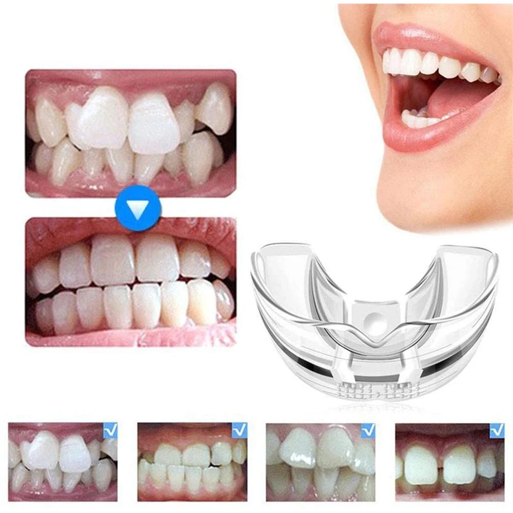 Ensemble Orthodontique Invisible en Silicone, Dispositif Dentaire, Retenue de Dents, Protège-Bouche, Bretelles, Outil de Soins Dentaires, 3 Étapes