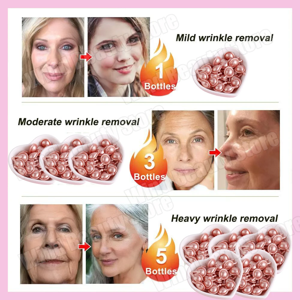 كبسولات حمض الهيالورونيك الوردي مصل مزيل التجاعيد...