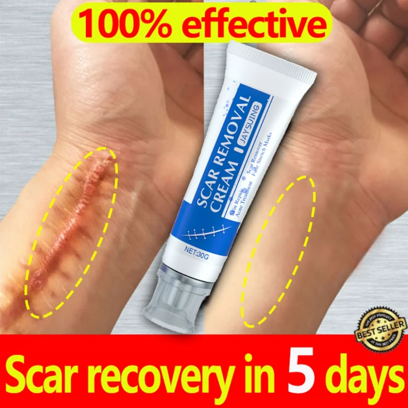 

5-Day Recovery Scar Cream Fast Removal Skin Scars Treat Surgery Stretch Marks Acne Pox Prints Burn Repair Facial Care Gel