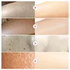 Body Whitening Cream Keratosis Pilaris Treatment Bumpy Rough Chicken Follicle Skin Repair Strawberry Legs Removal Dry Skin Care