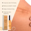 Stretch Marks Removal Cream Pregnant Women Repair Improve Sagging Moisturizing Nourish Soften Firming Belly Skin Smoothing Serum 6