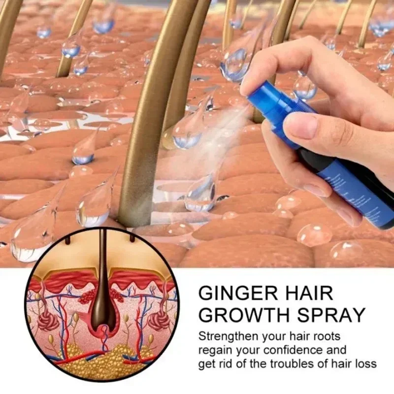 Hair Growth Spray Ginger Extract Prevent Baldness Promote Thicker Longer Anti Hair Loss