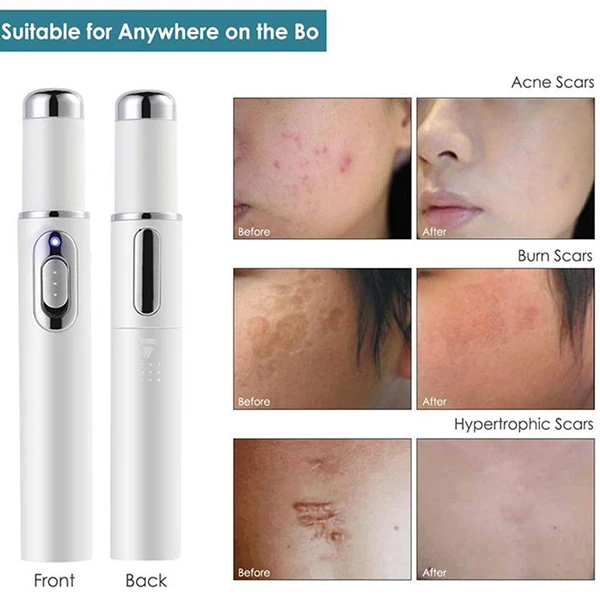 For Acne Laser Pen Portable Wrinkle Removal Machine Soft Scar Remover Device Blue Light Therapy Pen Massage