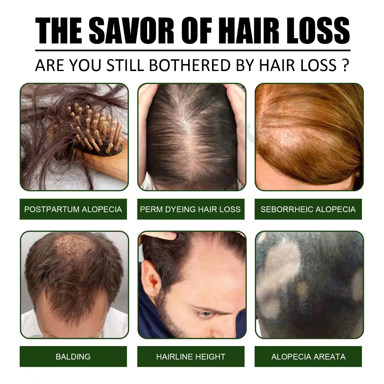 Description Picture 3 of itemHair Growth Oil Fast Hair Growth Effective Baldness Repair Hereditary Hair Loss Postpartum Hair Loss Seborrheic Hair Loss