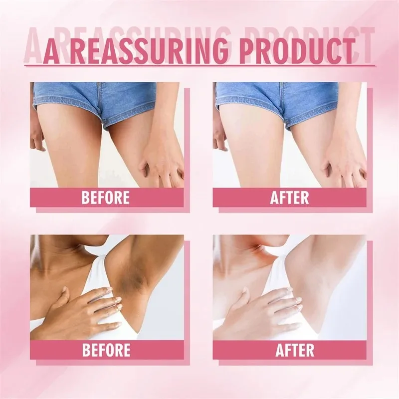 Brightening Private Parts Cream Knuckles Underarm Bleaching Cream Butt Knee Brighten Emulsion Inner Thigh Armpit Remove Melanin 4