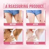 Brightening Private Parts Cream Knuckles Underarm Bleaching Cream Butt Knee Brighten Emulsion Inner Thigh Armpit Remove Melanin 4