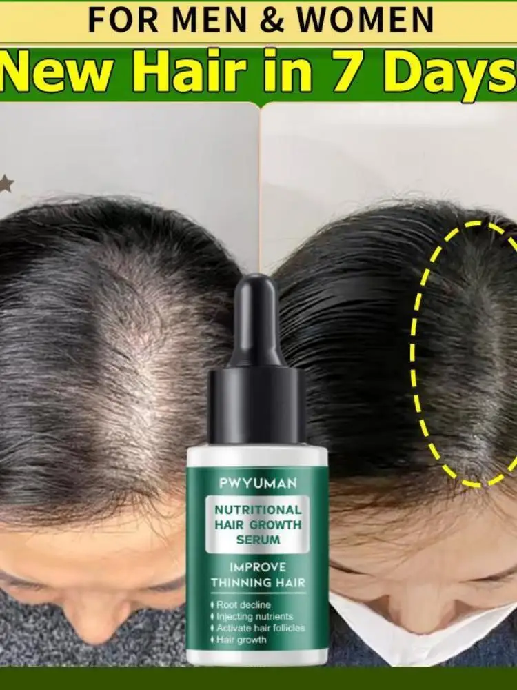 Ginger Hair Growth Product Anti-loss Hair Regrowth Serum Oil Fast Grow Prevent Baldness Treatment Alopecia Men Women Hair Care