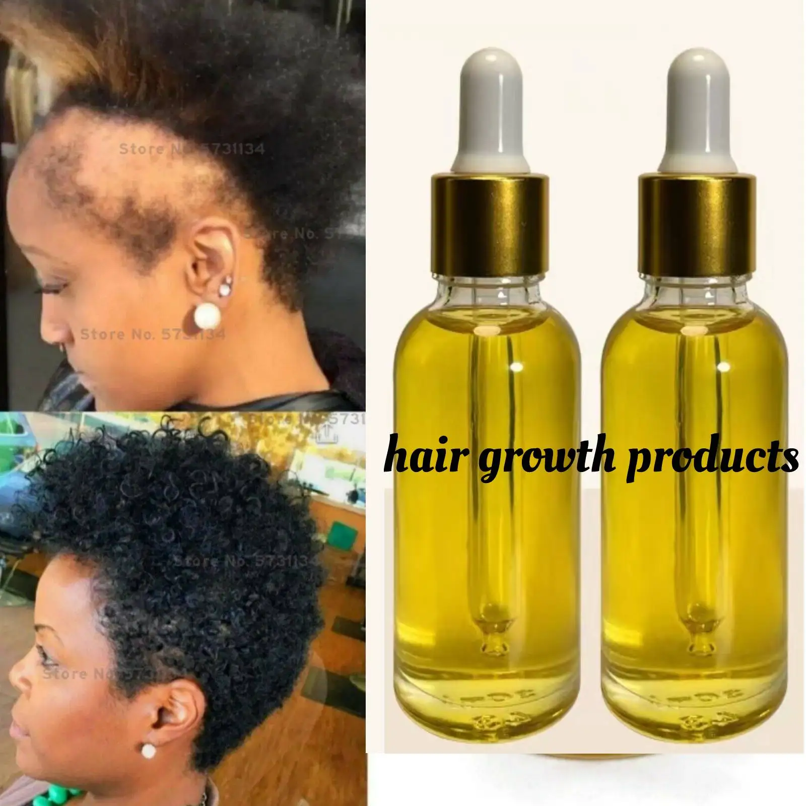 

Продукты для роста волос, масло из черных семян, масло для быстрого роста волос для черных женщин, косметический уход за волосами, предотвращение выпадения волос, масло для кожи головы