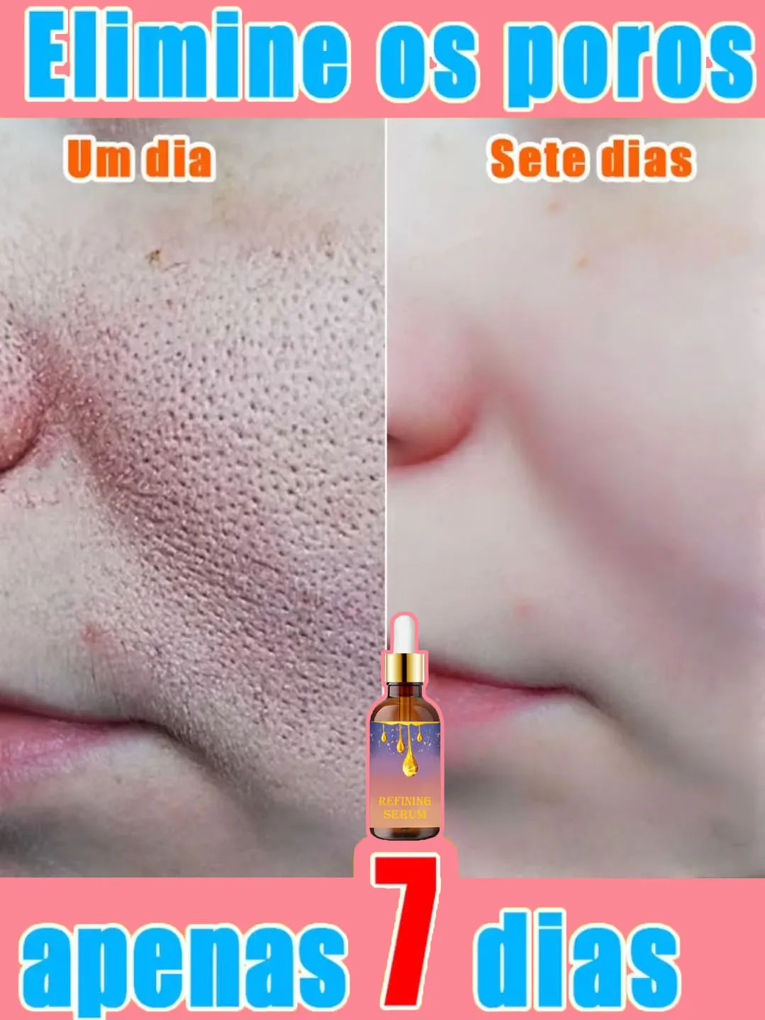 La esencia de los poros puede aliviar, secar e hidratar la Cara. Puede usarse para el cuidado de la piel sensible