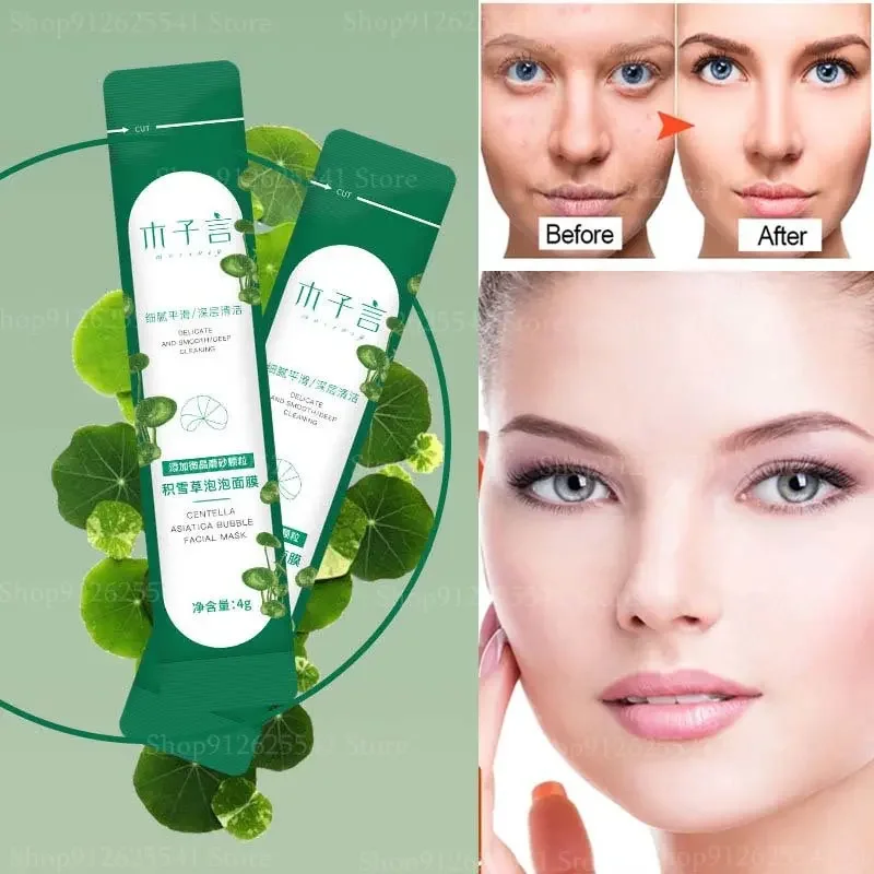 

4 г X 12 шт./коробка, маска для глубокого очищения