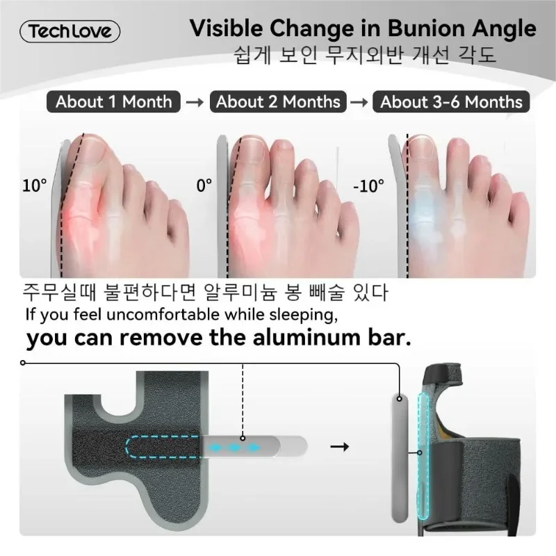 Tech Love Hallux Valgus Corrector Toe Straightener for Toe Alignment and Bunion Pain Relief Foot Care Tools