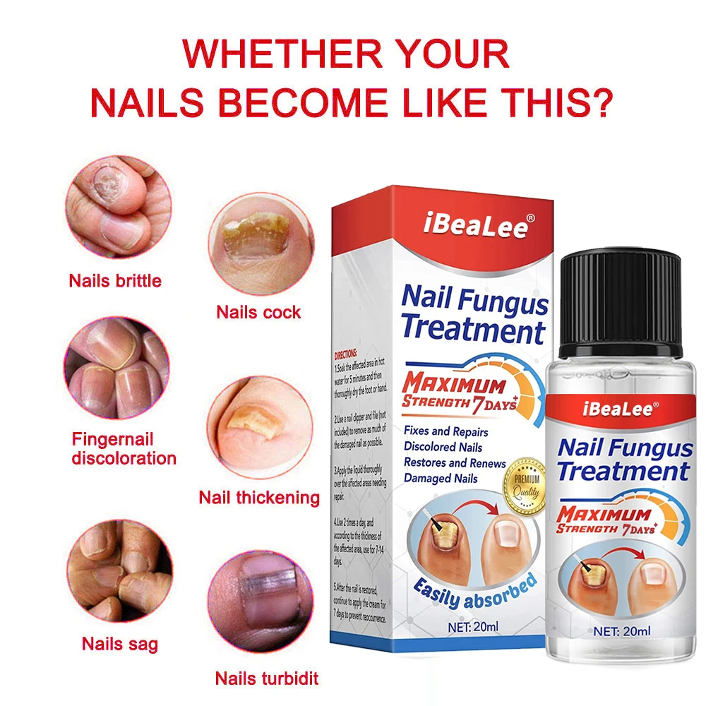 

7DAYS Feet Nail Fungus Treatment Essence Serum Care Oil Nails fungal Removal Repair Gel Hand And Foot Care Anti-Infective