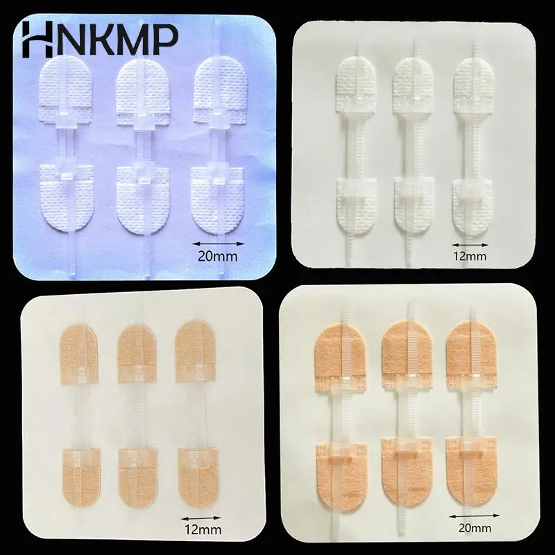 ZipperBandaidPainlessWoundClosureDeviceSuturefreeWound